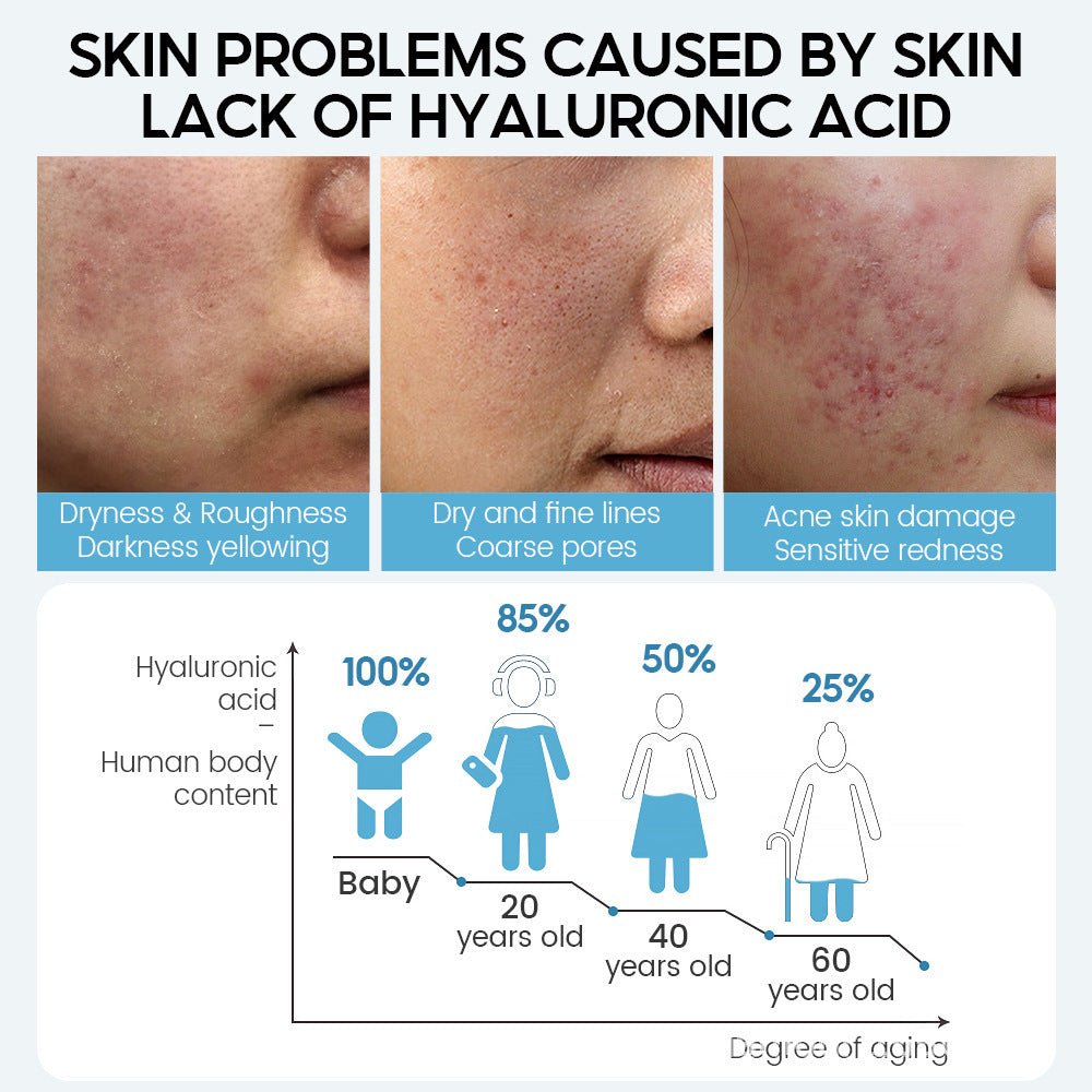 Glowrise™ Hyaluronic Acid Serum – Hydrating & Anti-Aging Formula