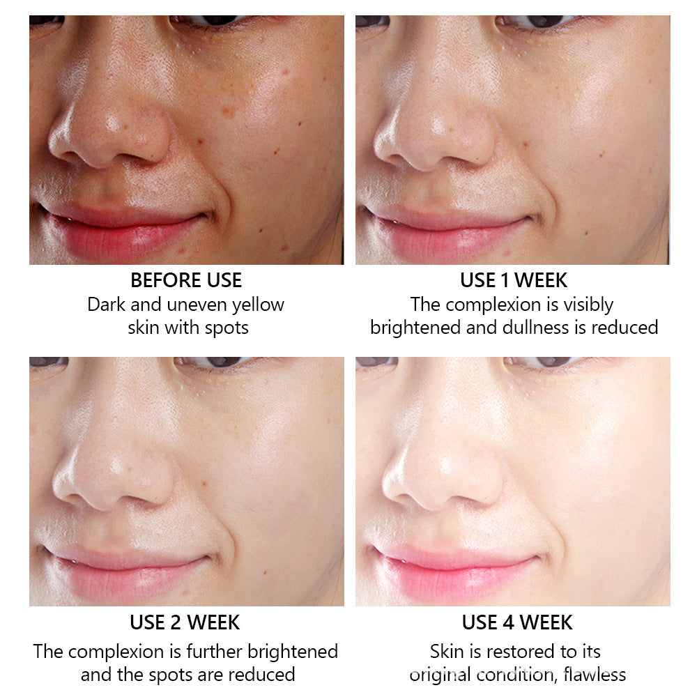 Glowrise™ Vitamin C Brightening Facial Serum – Glowing, Youthful Skin in Every Drop