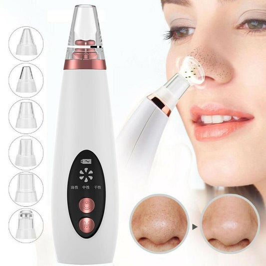 Glowrise™ Blackhead Remover Pore Vacuum – Deep Facial Cleanser & Suction Tool